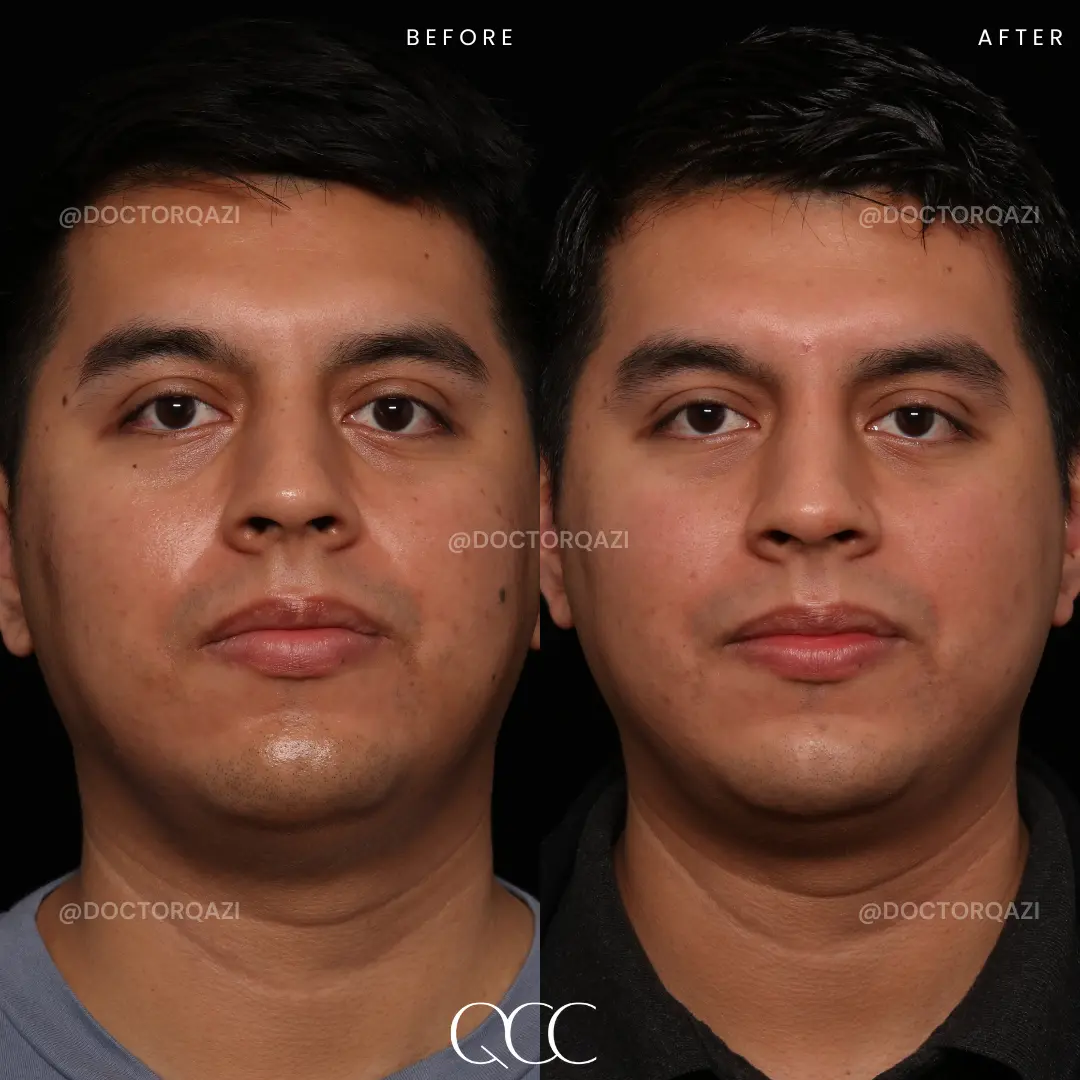 gallery.image.item,3