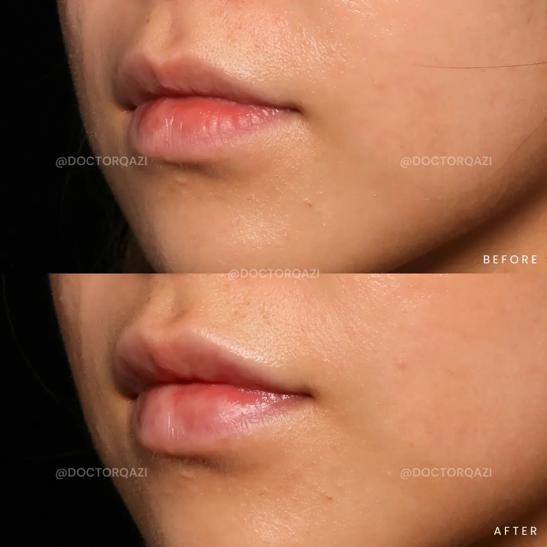 gallery.image.item,32