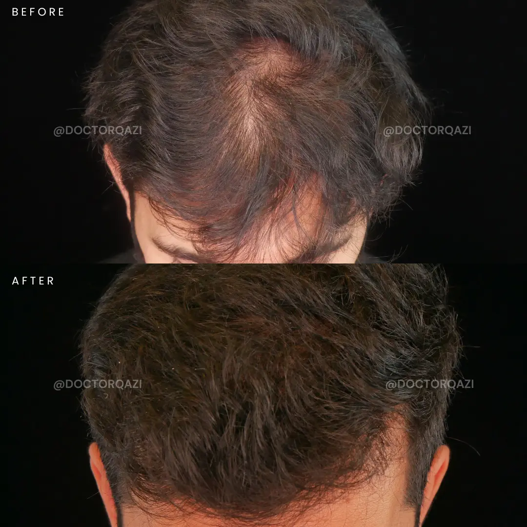 gallery.image.item,35