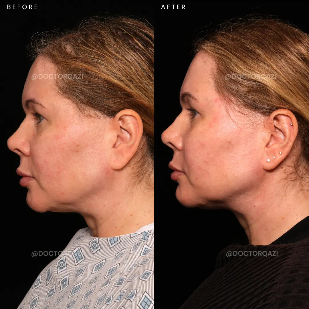 gallery.image.item,37