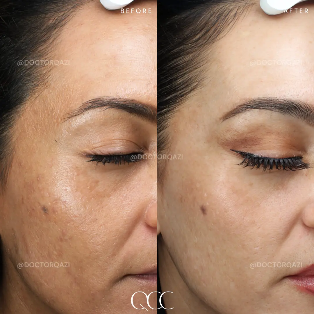 gallery.image.item,38