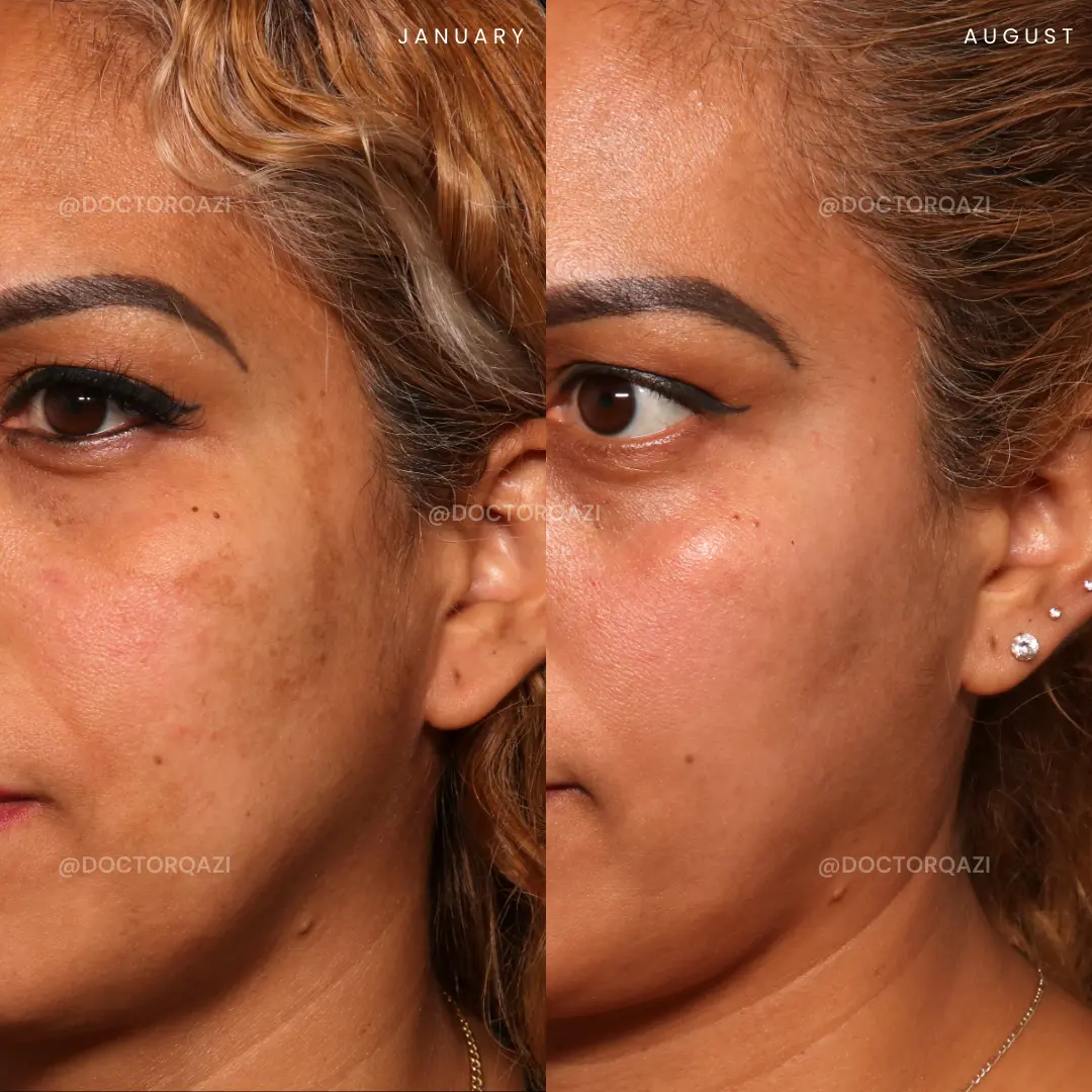 gallery.image.item,39