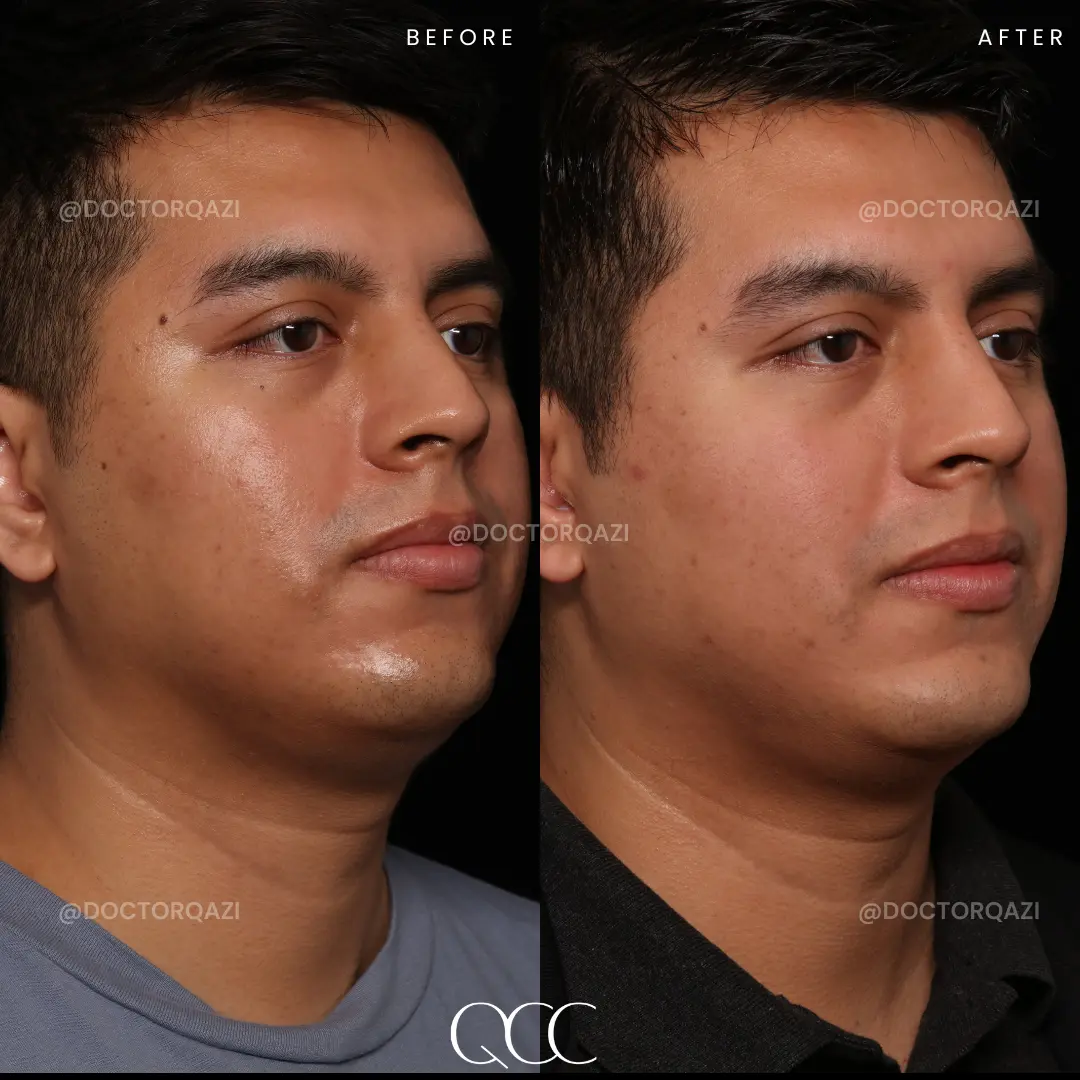 gallery.image.item,4