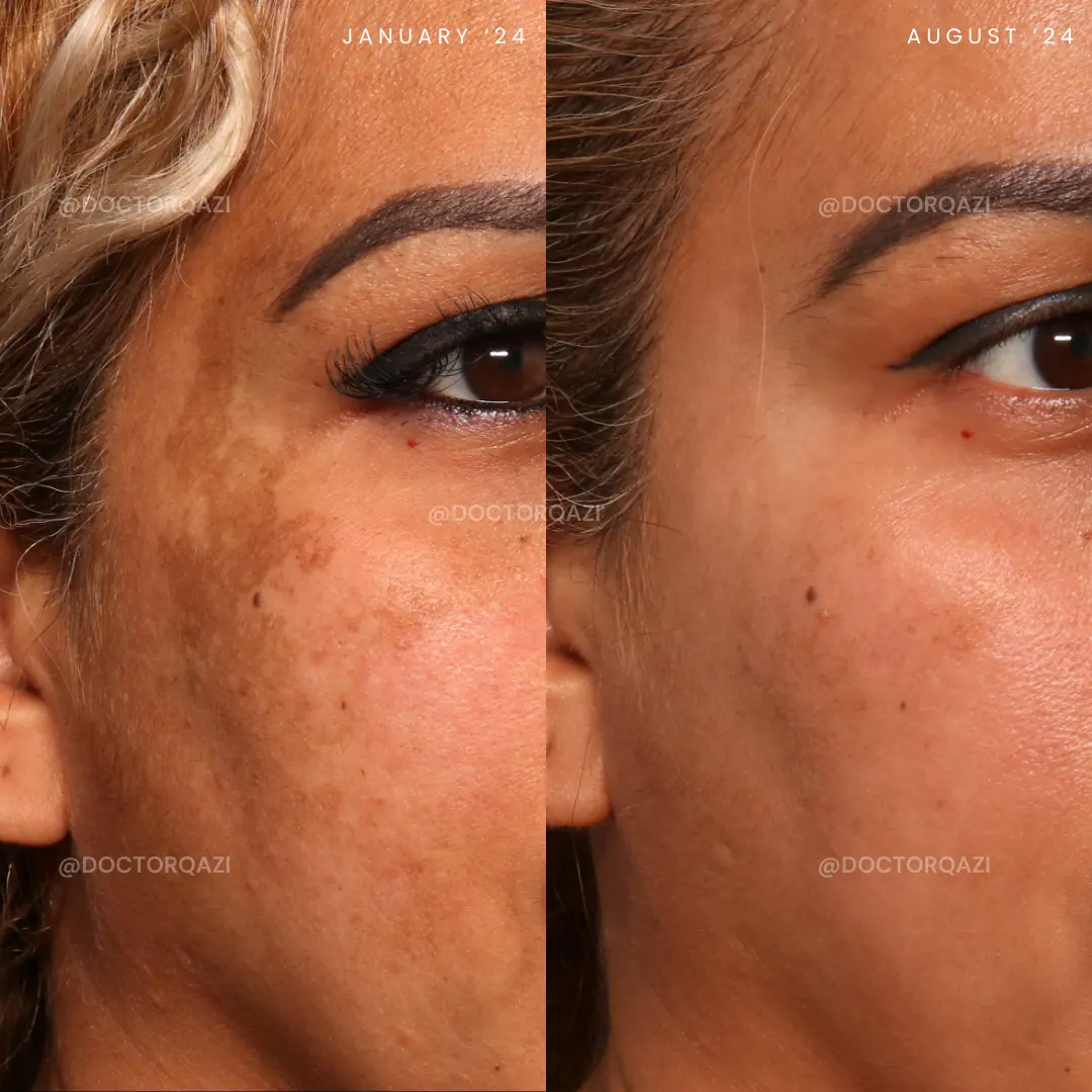 gallery.image.item,41