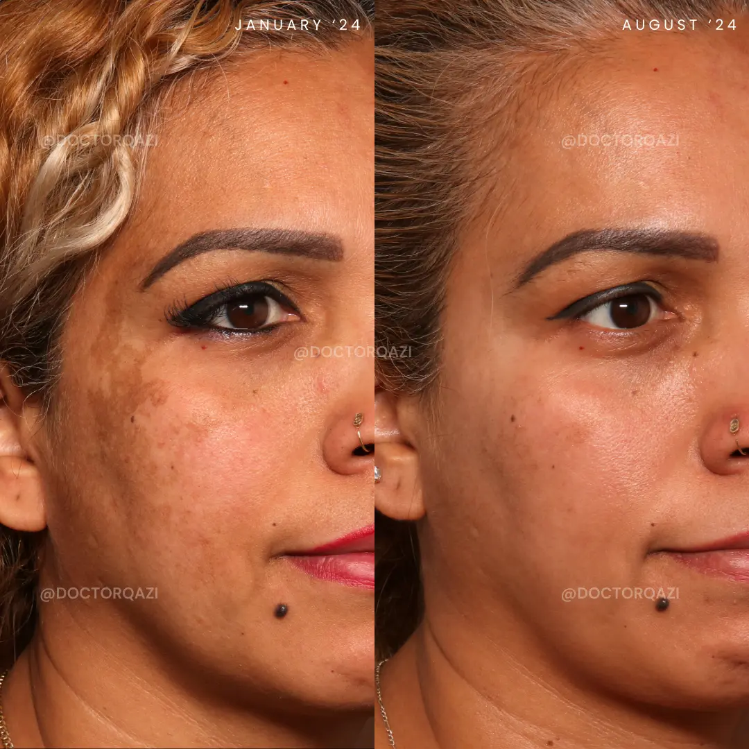 gallery.image.item,42