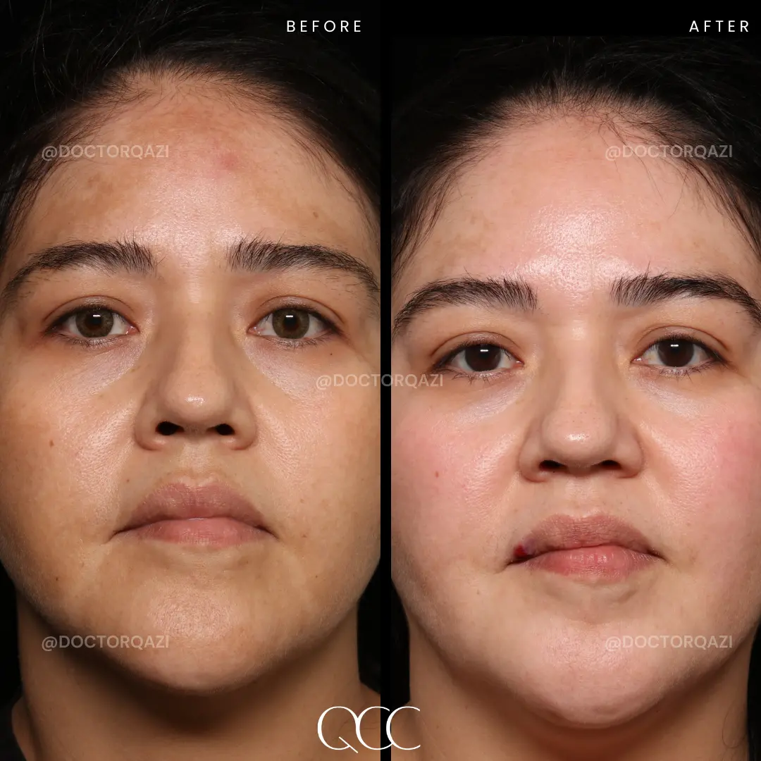 gallery.image.item,46