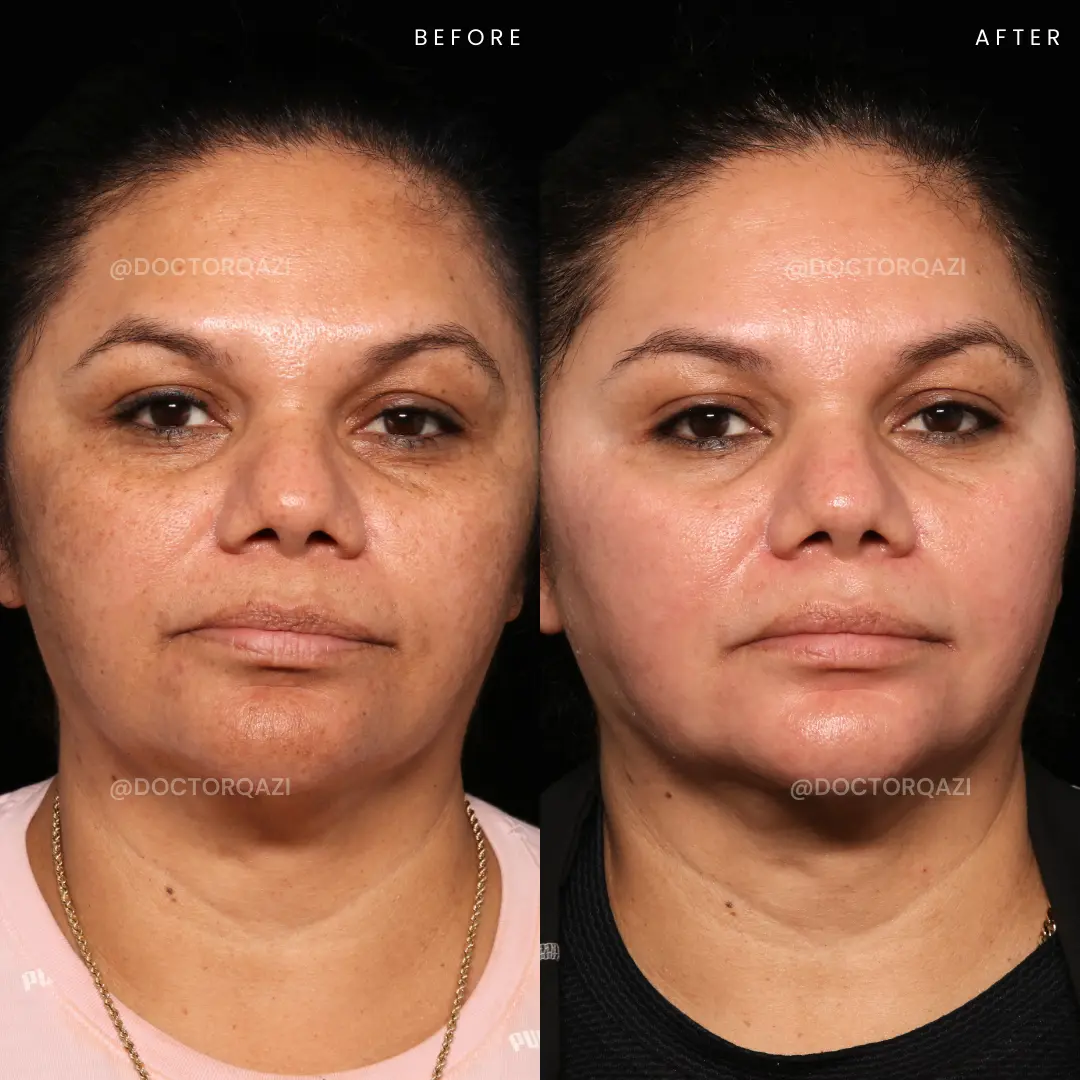 gallery.image.item,47