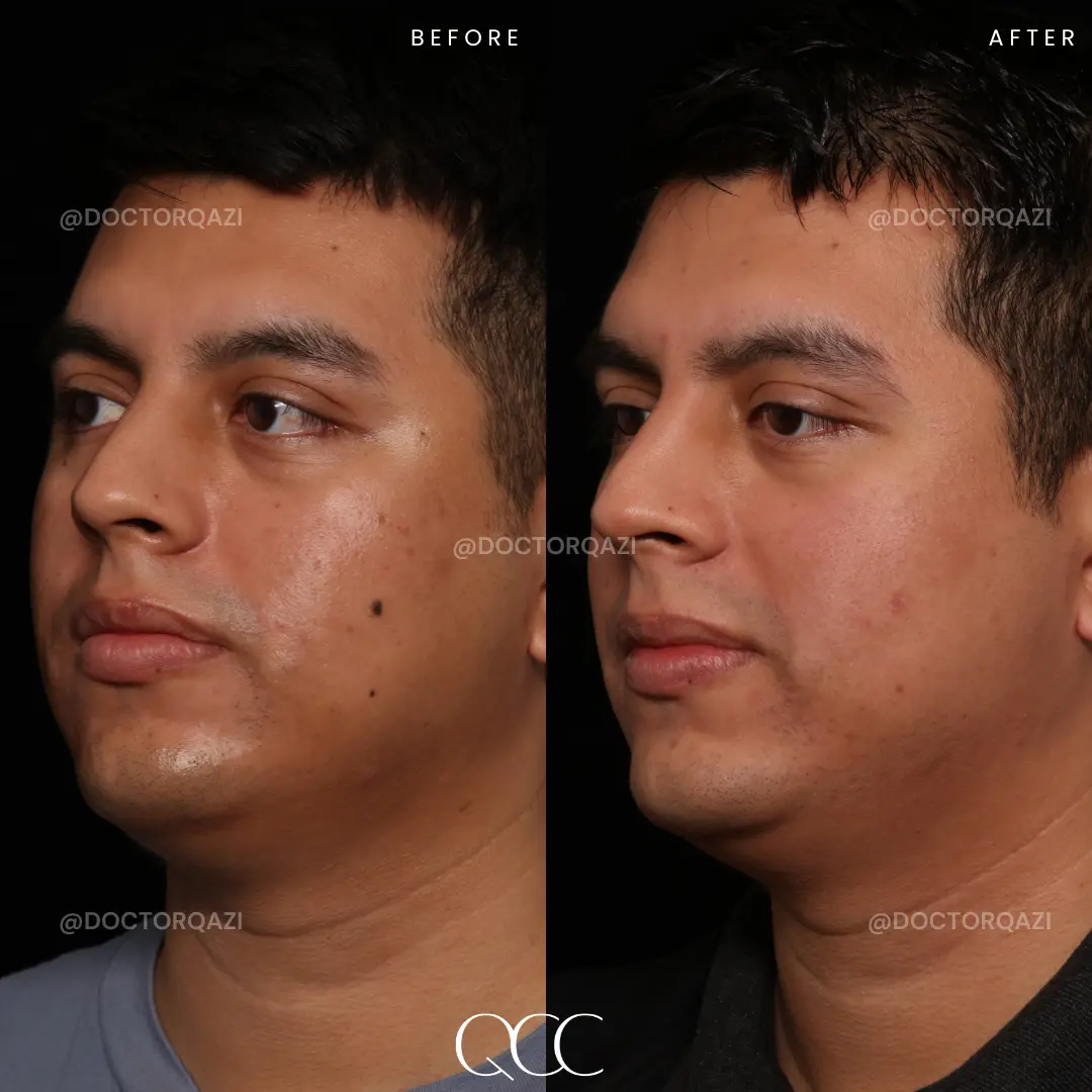 gallery.image.item,5