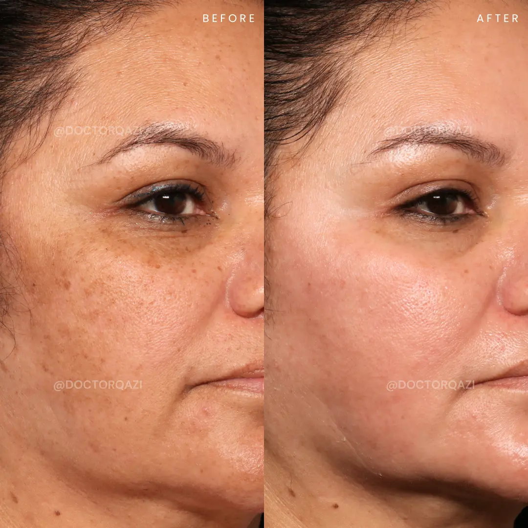 gallery.image.item,50