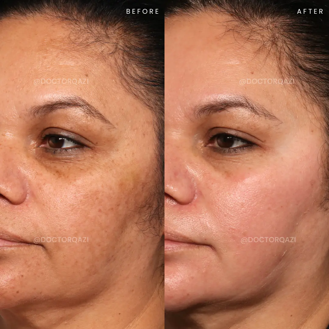 gallery.image.item,51