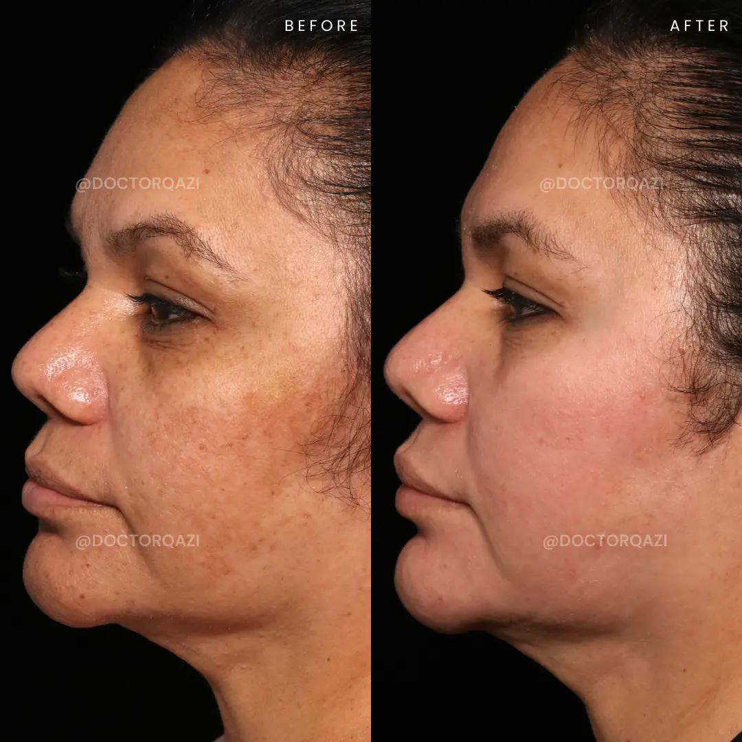 gallery.image.item,52