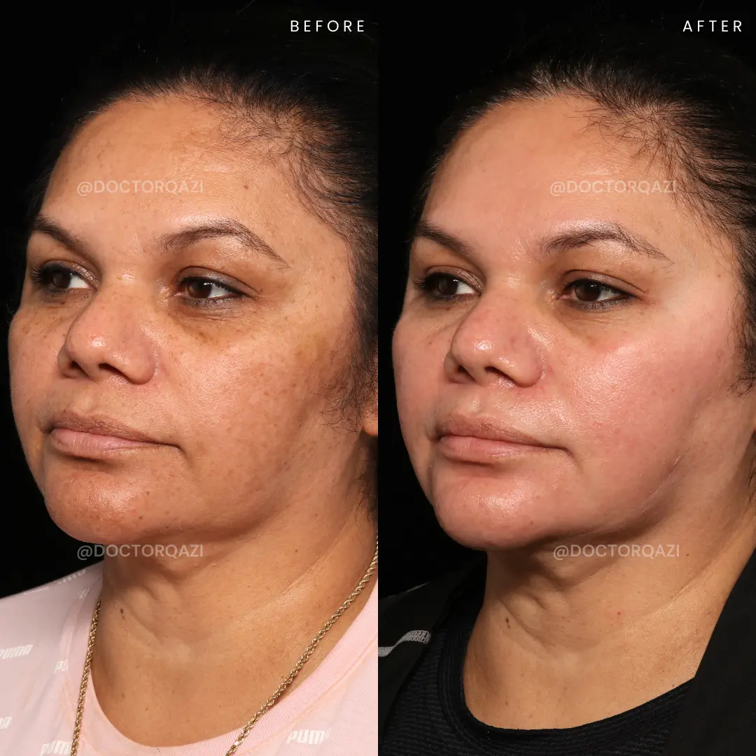 gallery.image.item,53