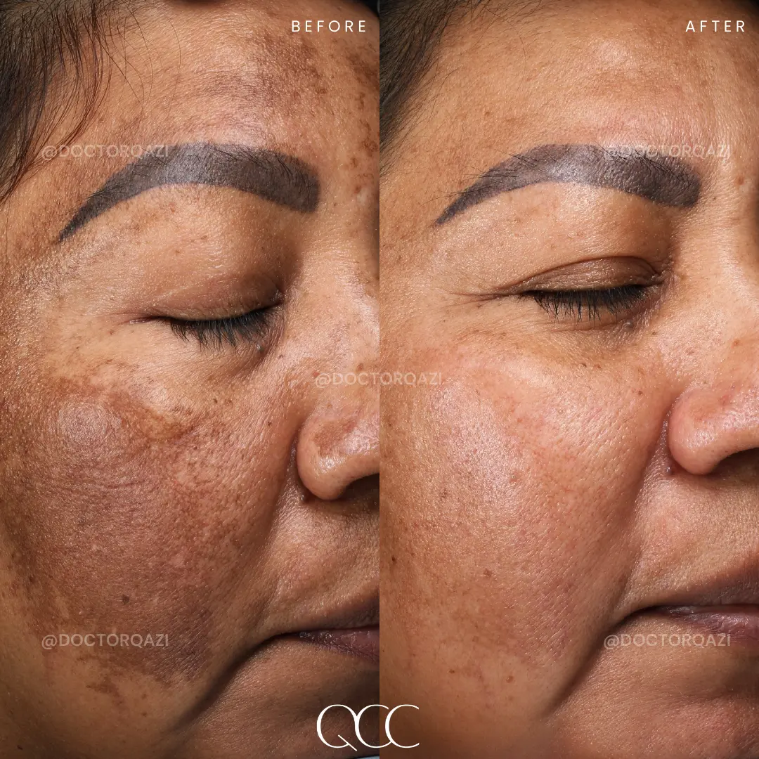 gallery.image.item,54