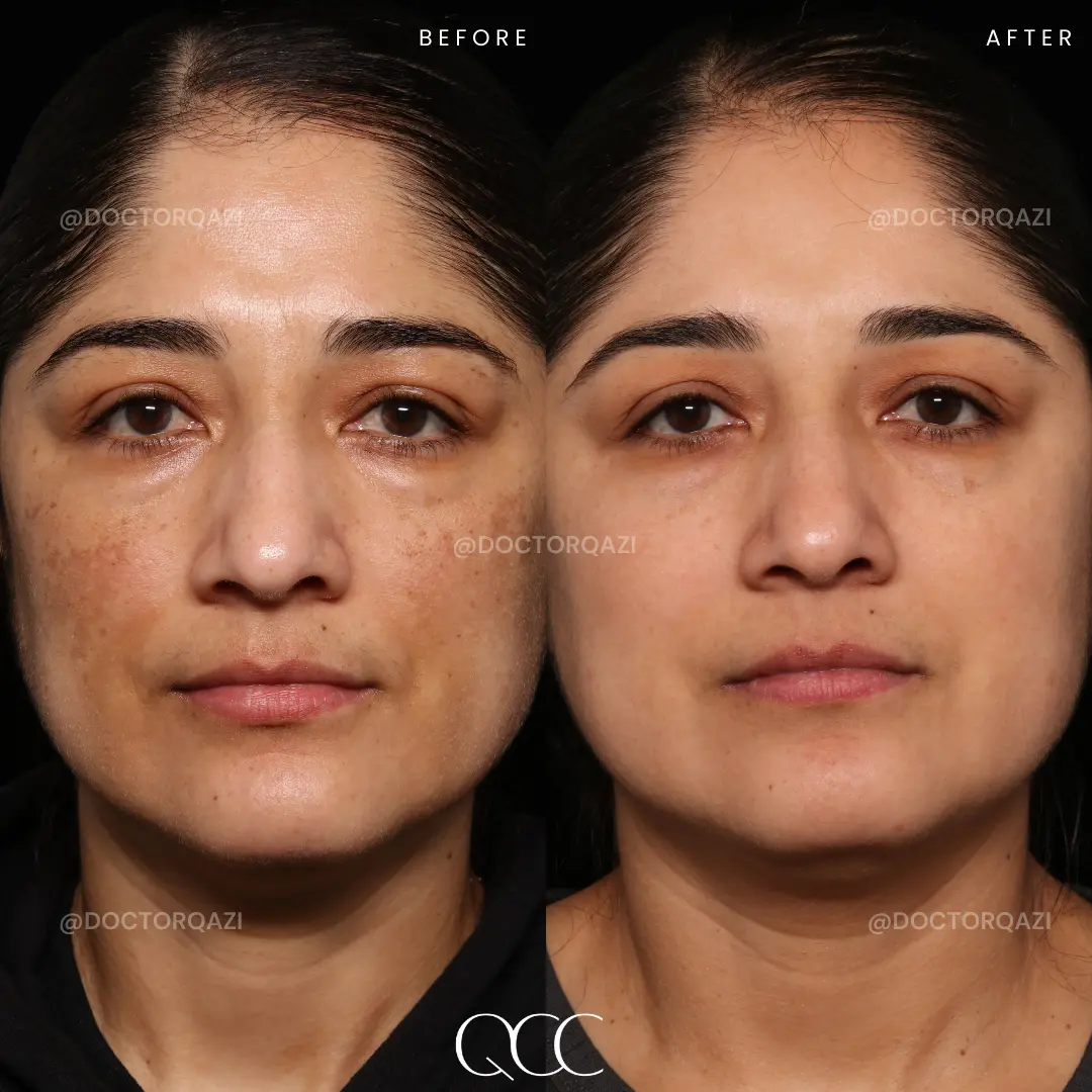 gallery.image.item,55