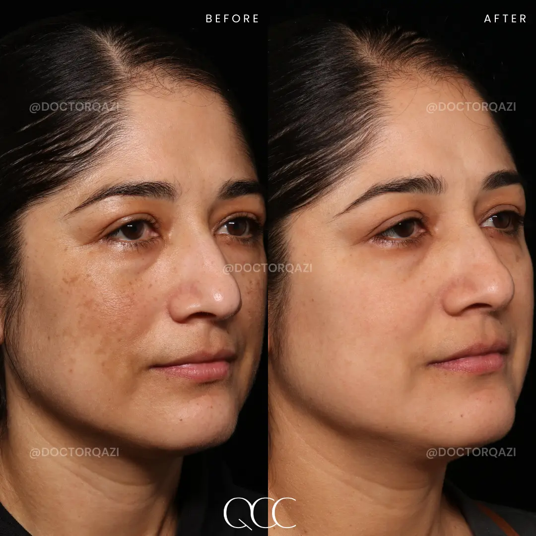 gallery.image.item,56