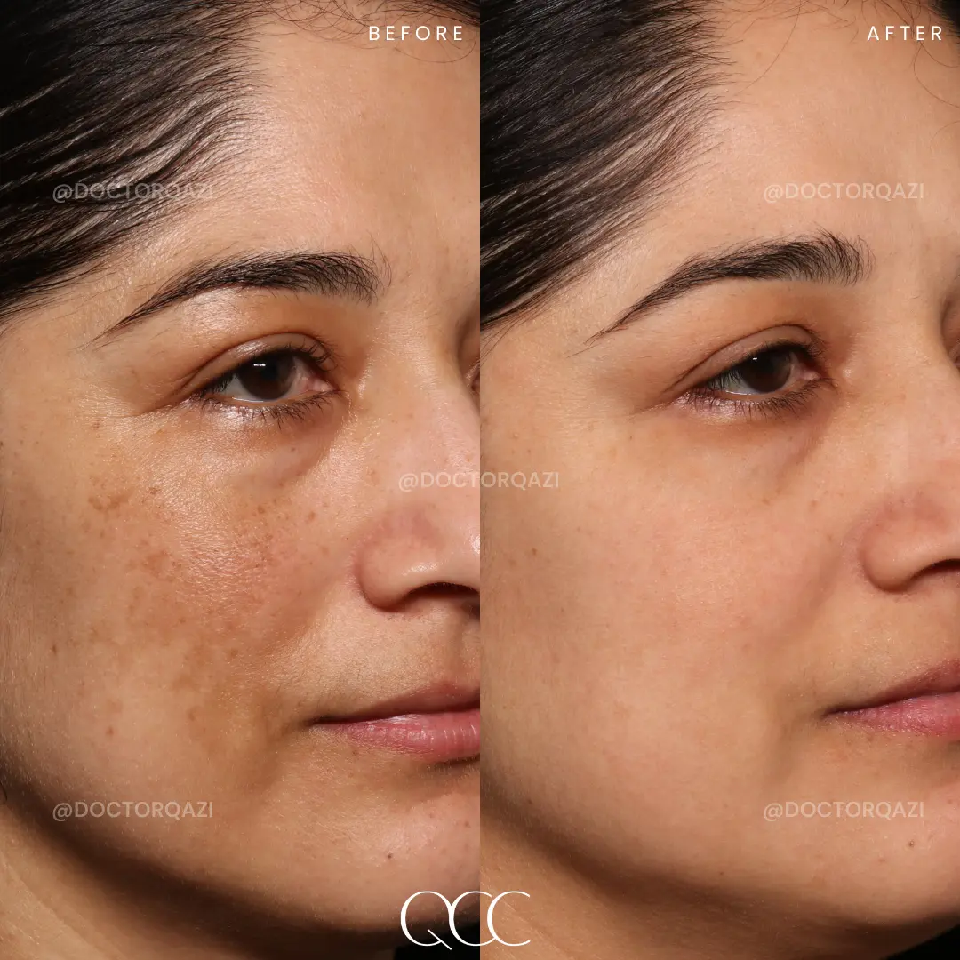 gallery.image.item,57