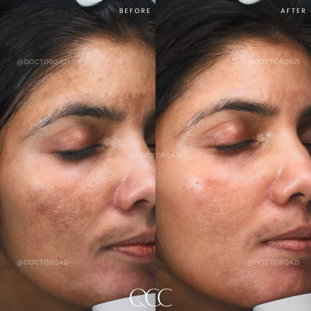 gallery.image.item,59