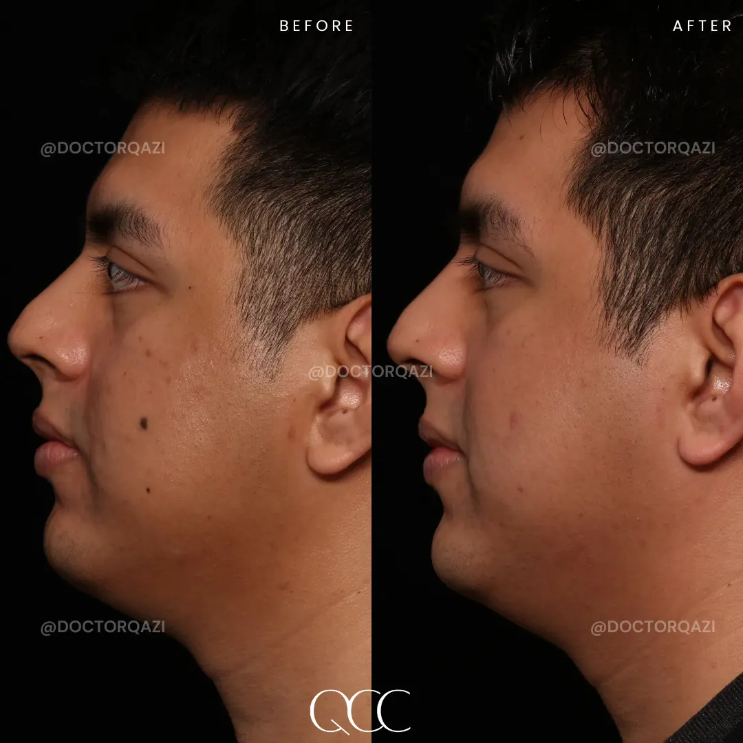 gallery.image.item,6