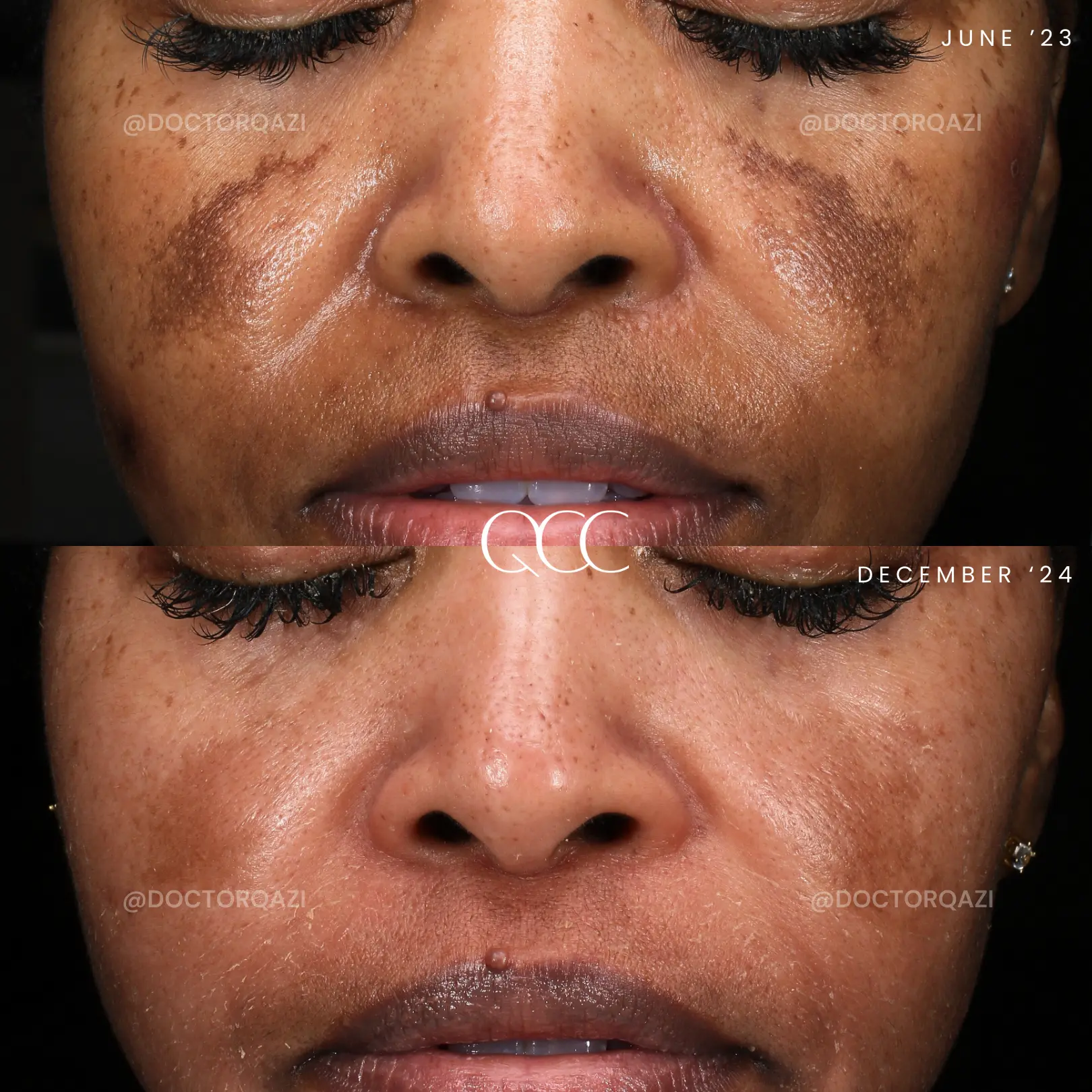 gallery.image.item,60