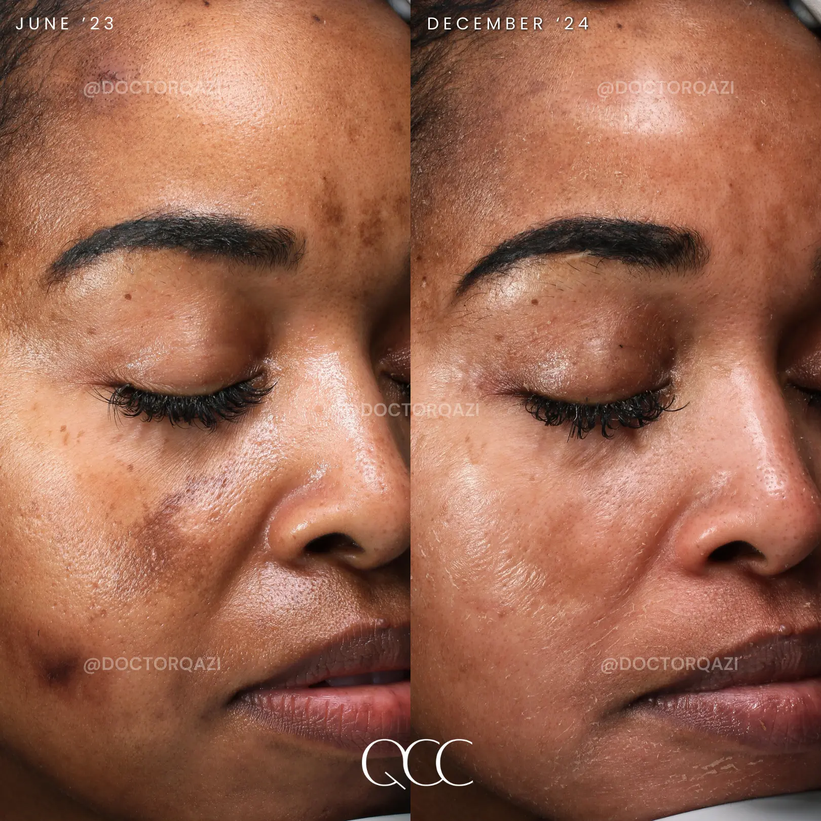 gallery.image.item,61