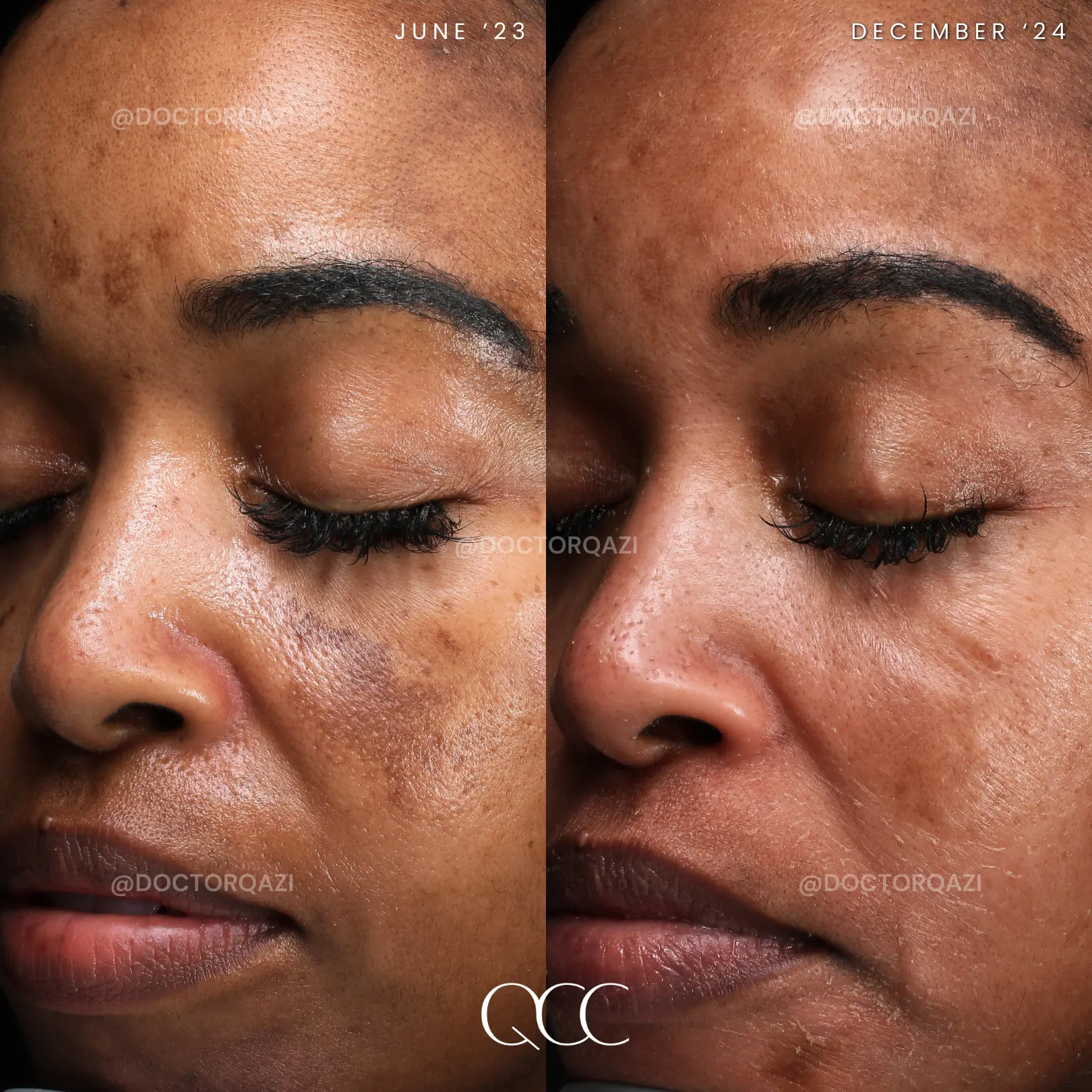 gallery.image.item,62