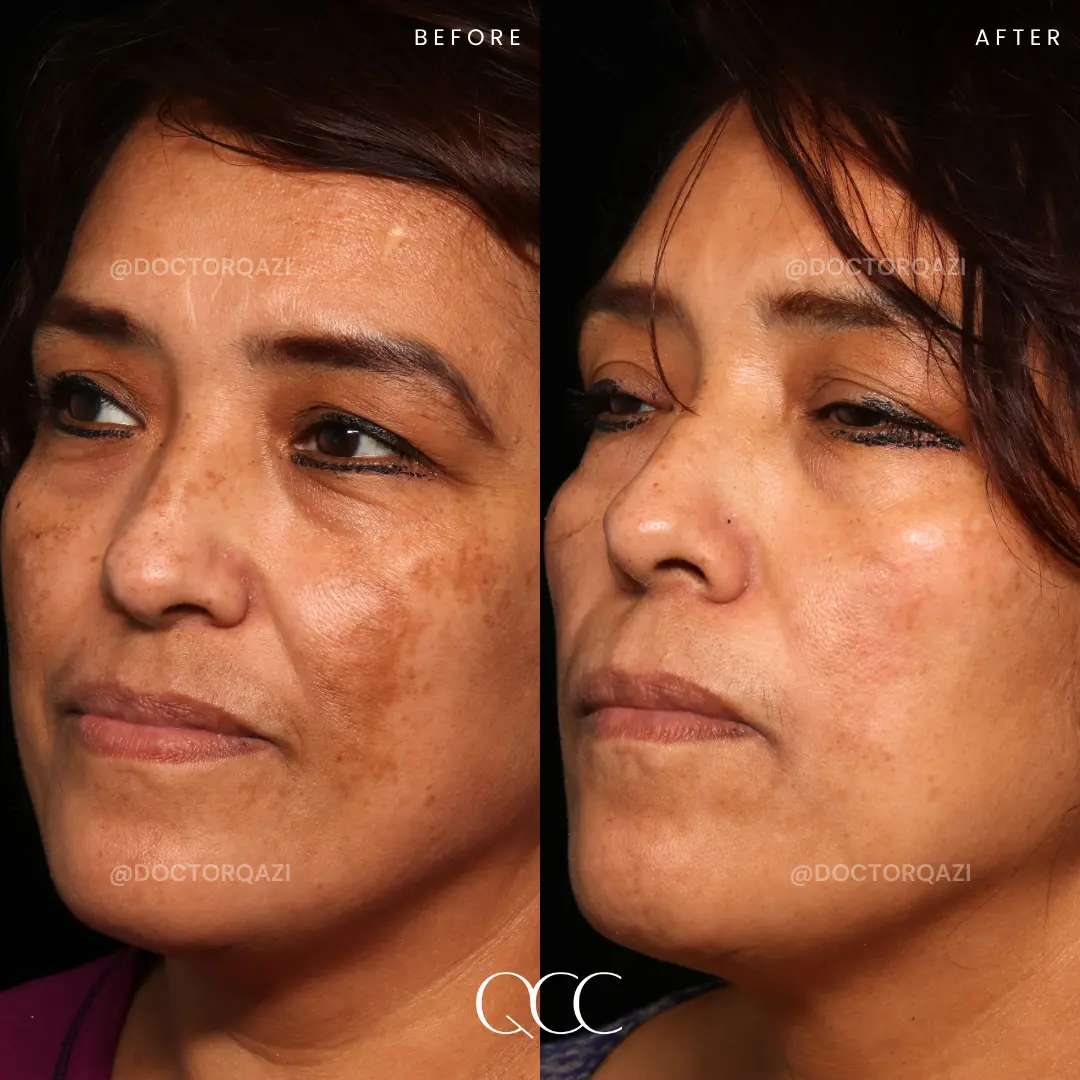 gallery.image.item,64