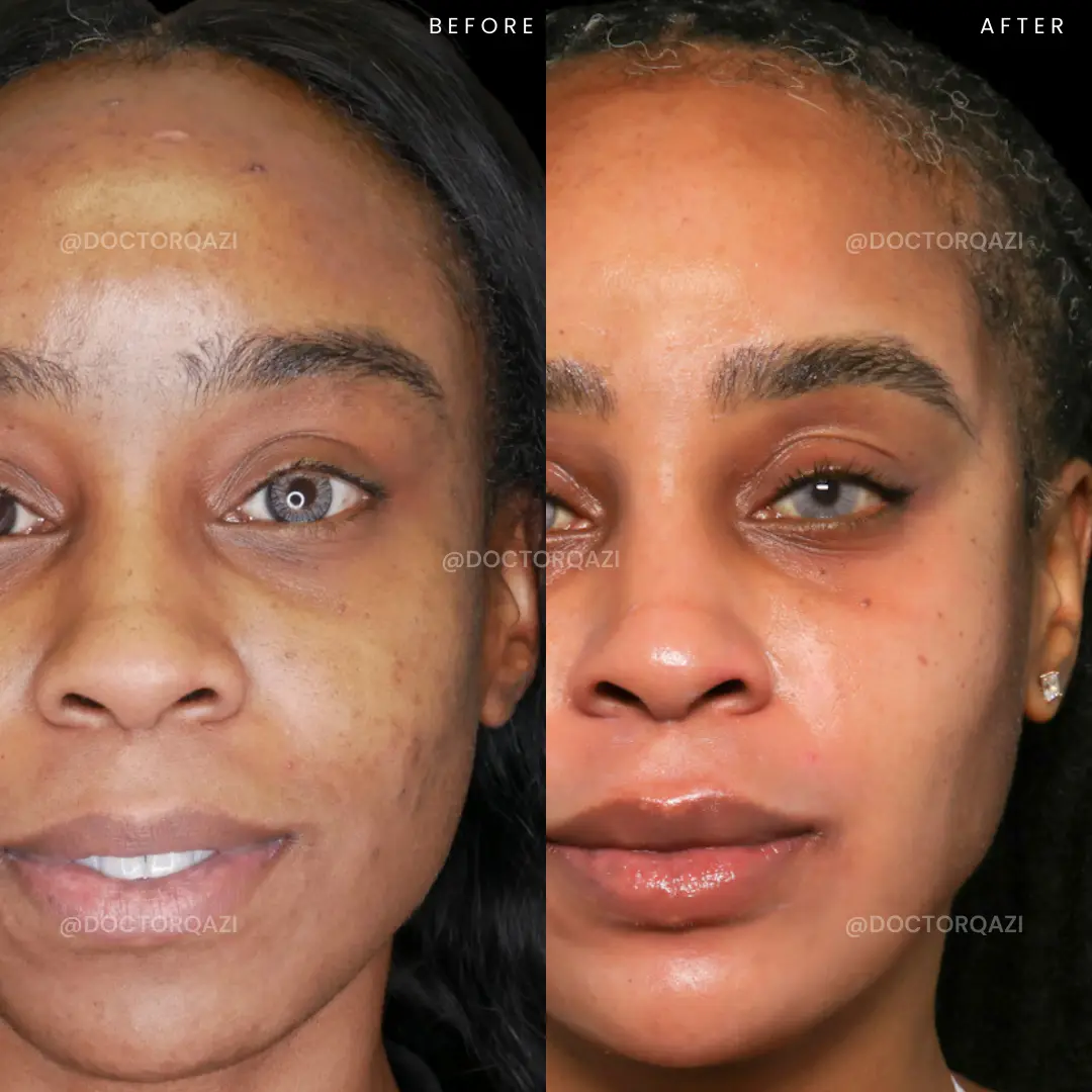 gallery.image.item,65