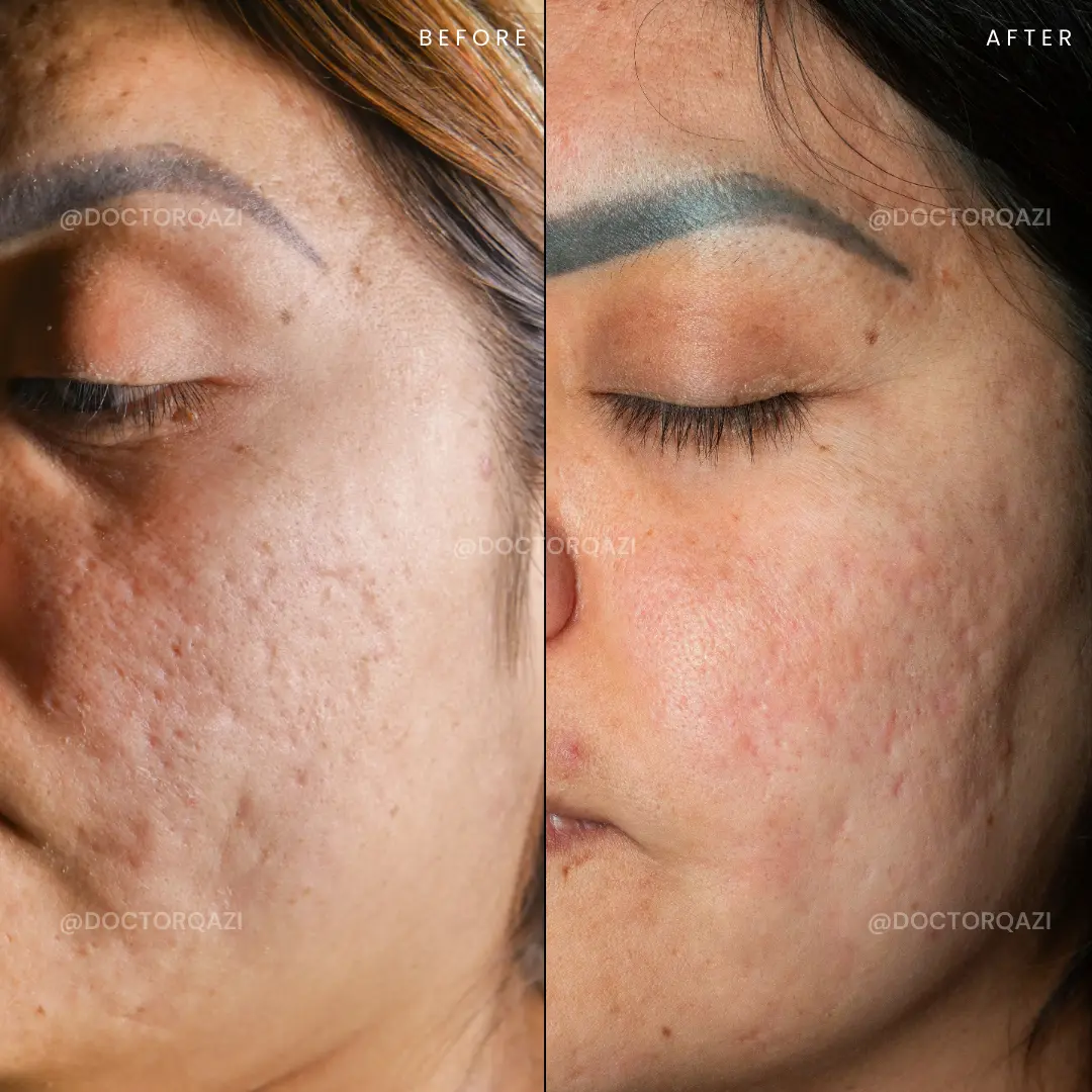 gallery.image.item,66