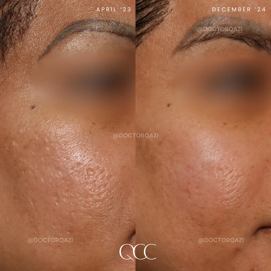 gallery.image.item,68