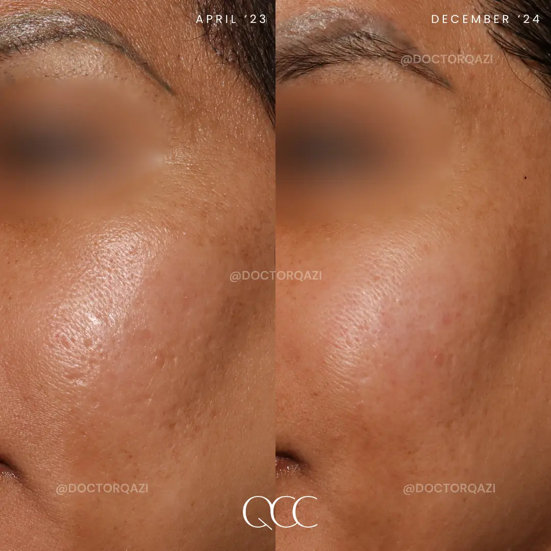 gallery.image.item,69