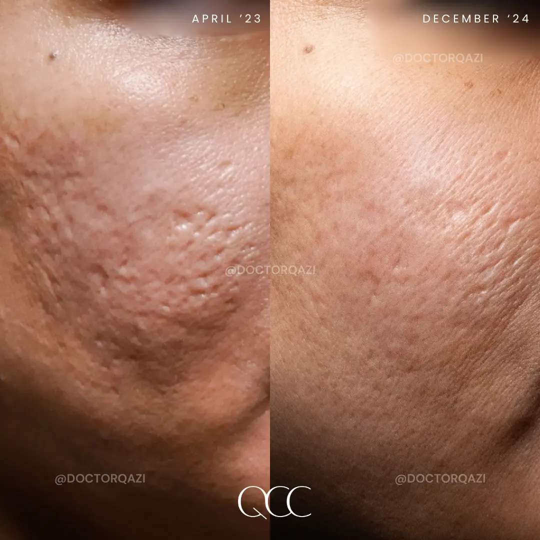 gallery.image.item,71