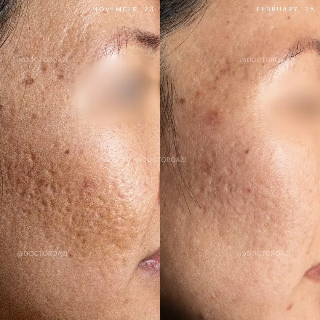 gallery.image.item,73