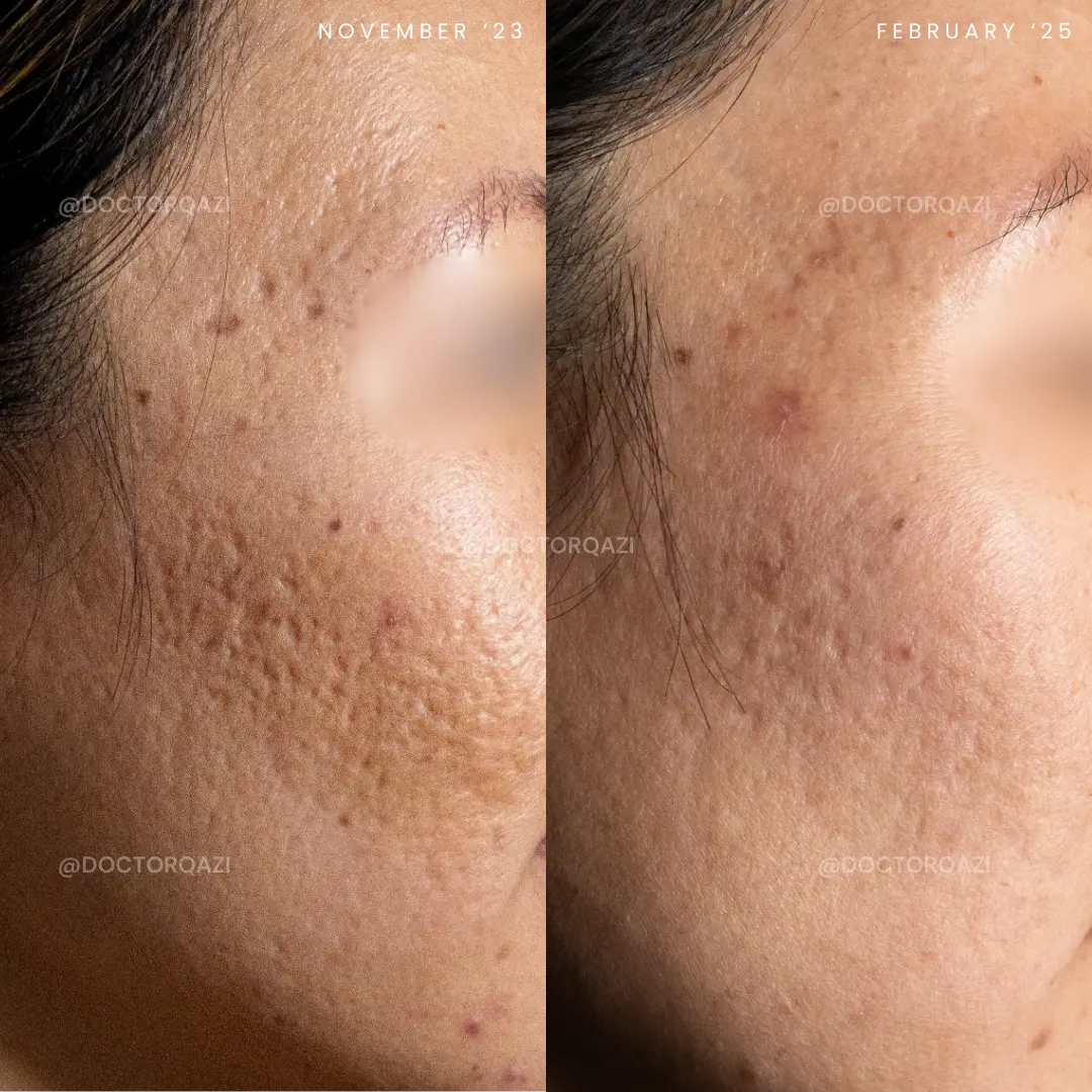 gallery.image.item,74