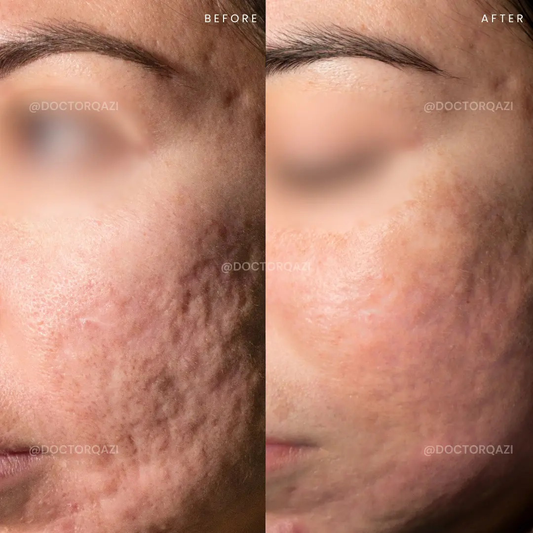 gallery.image.item,76