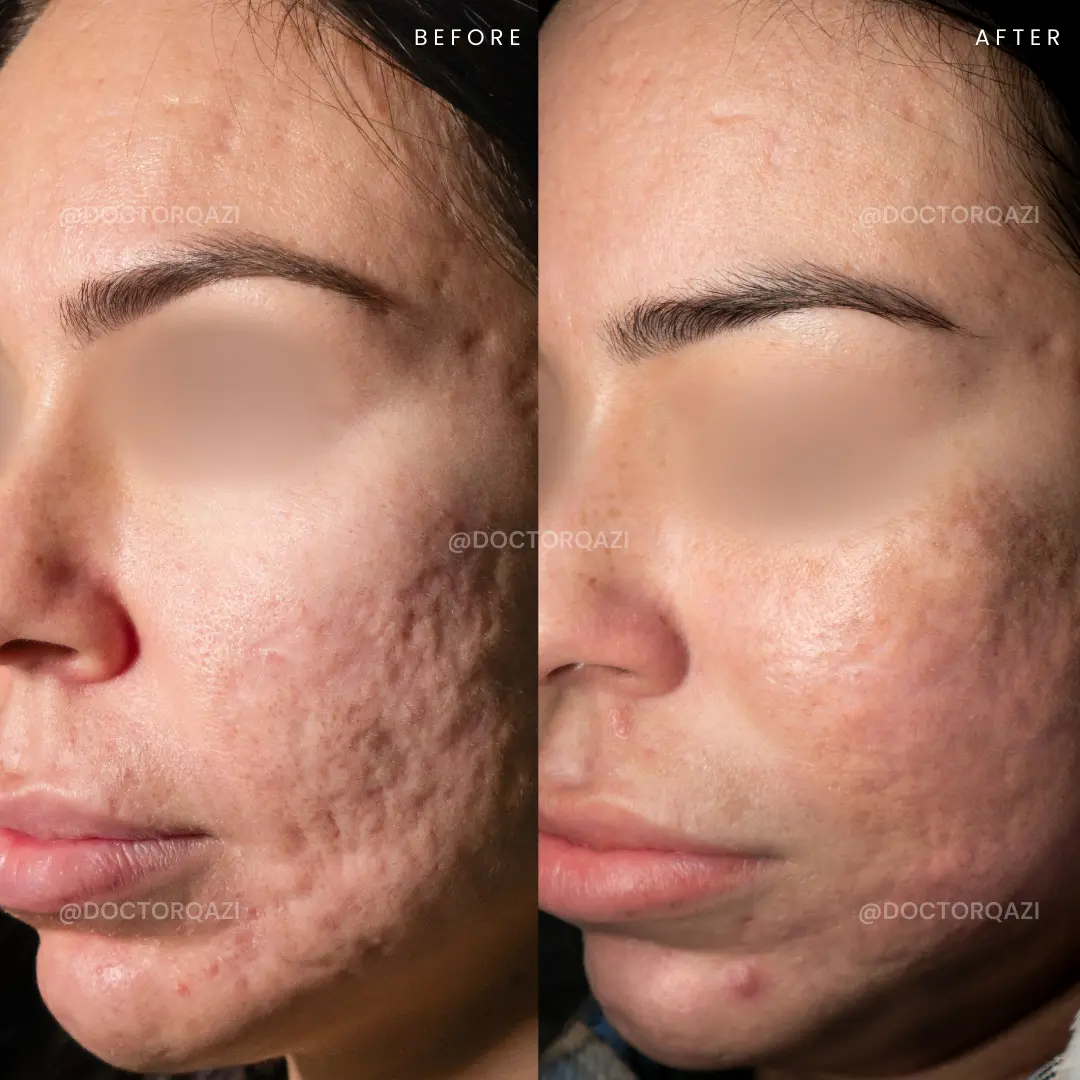 gallery.image.item,77