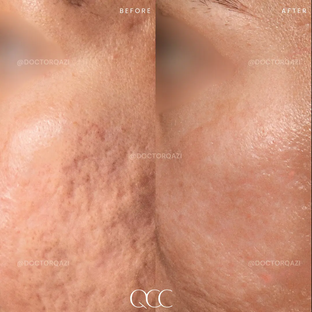 gallery.image.item,78