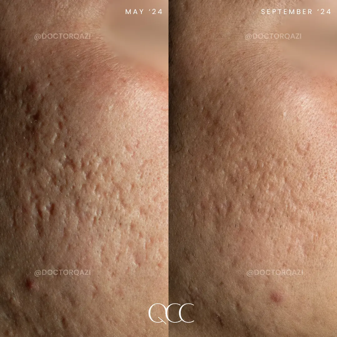 gallery.image.item,82