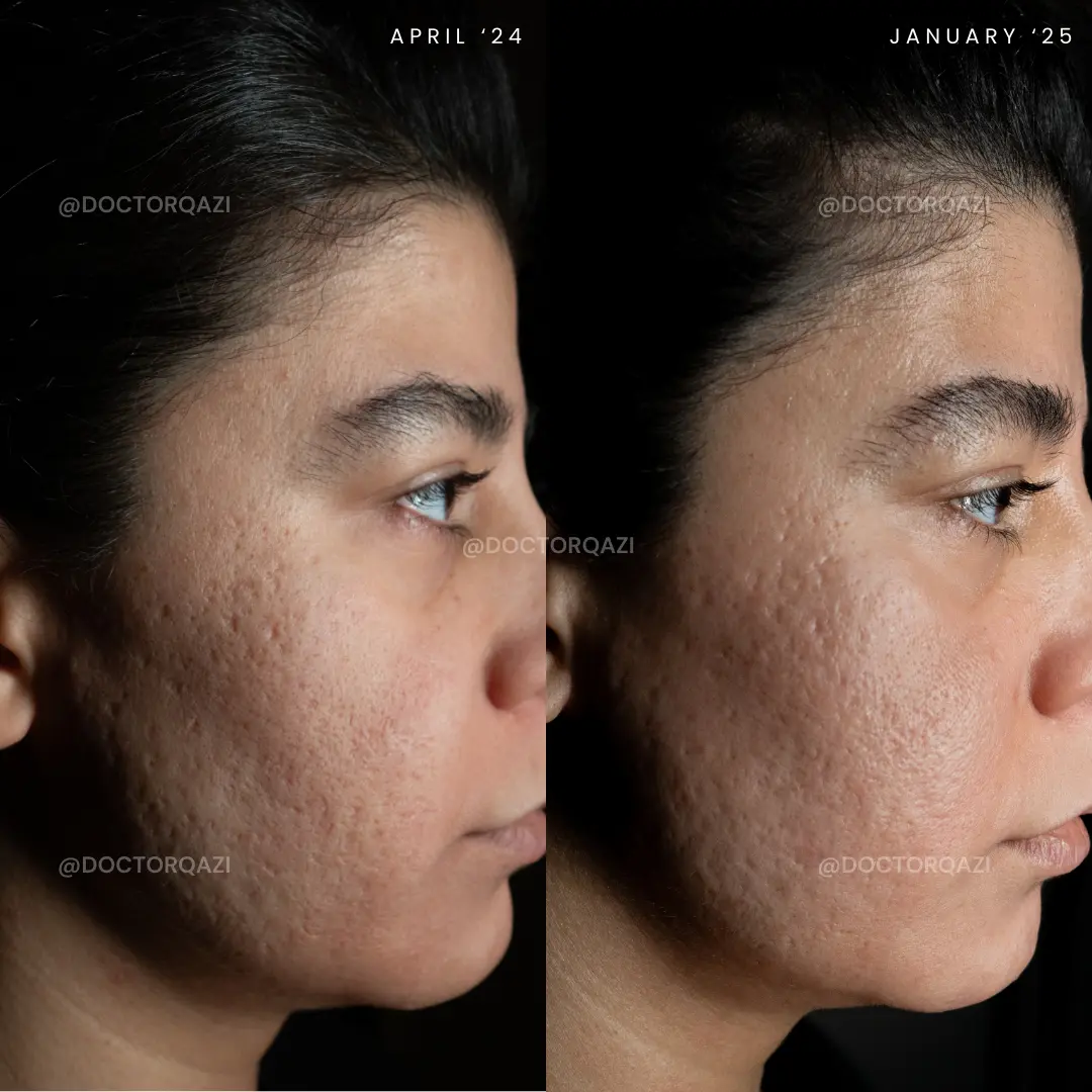 gallery.image.item,84