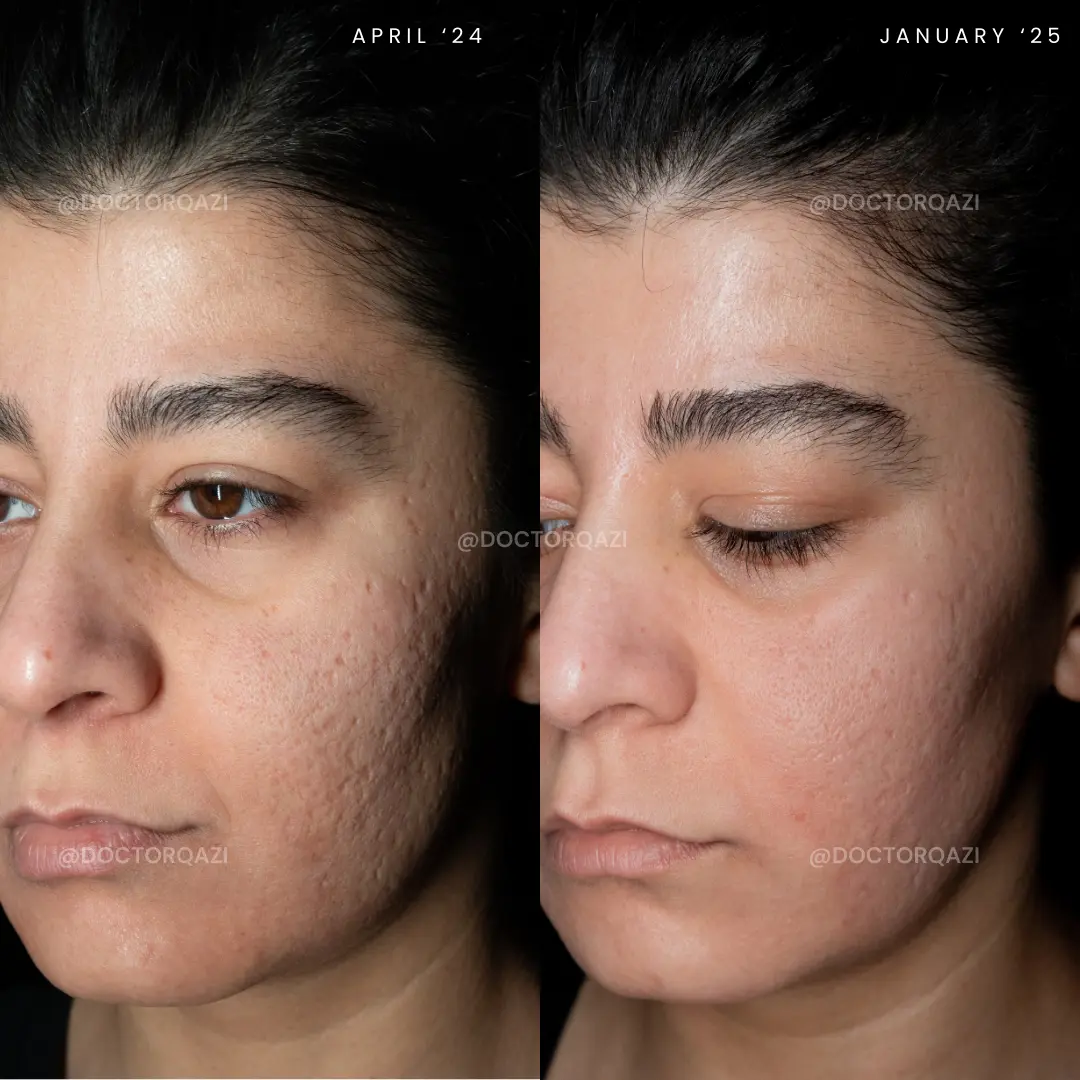 gallery.image.item,85