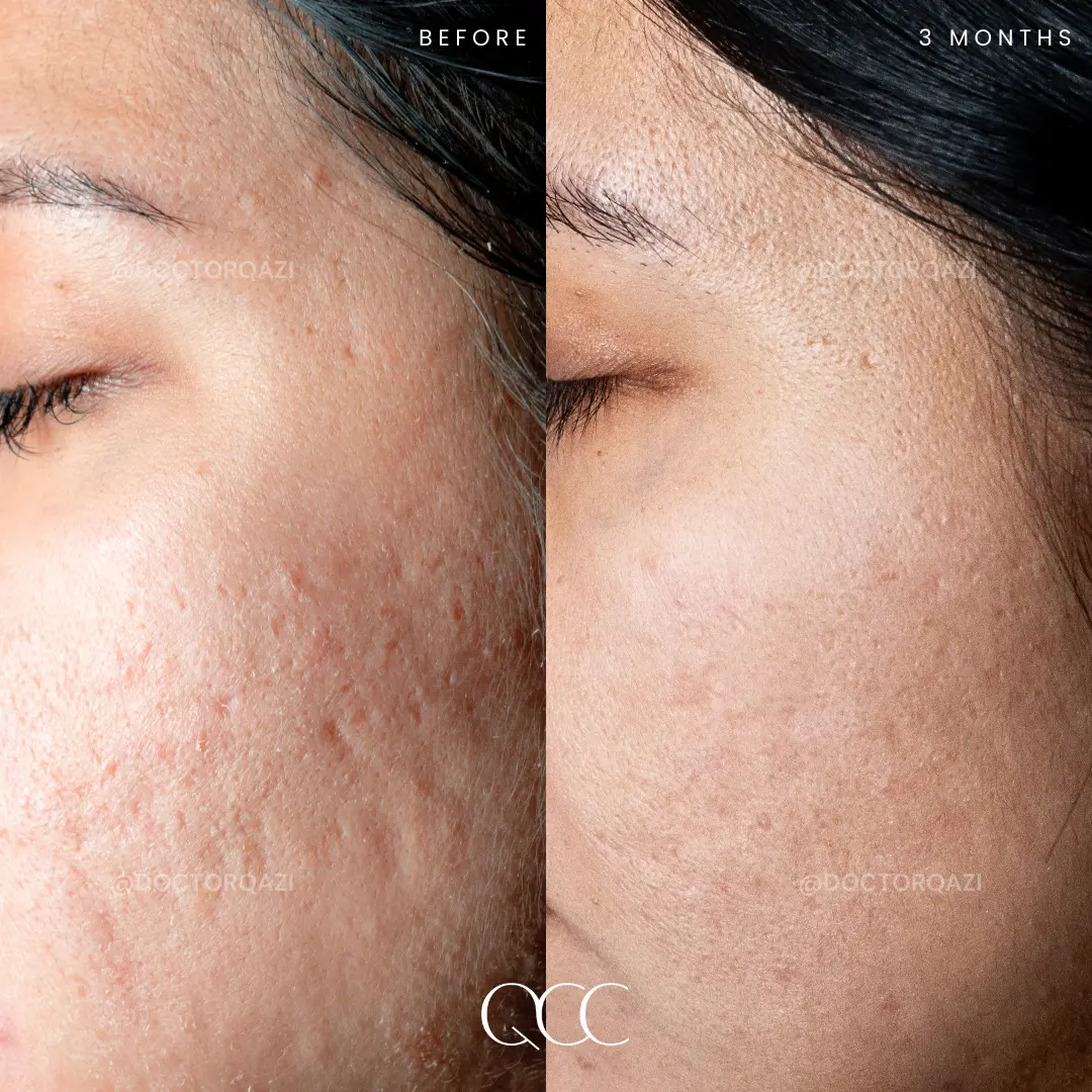 gallery.image.item,87