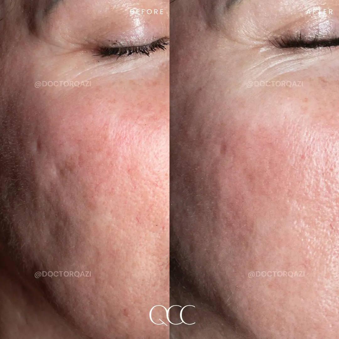 gallery.image.item,89