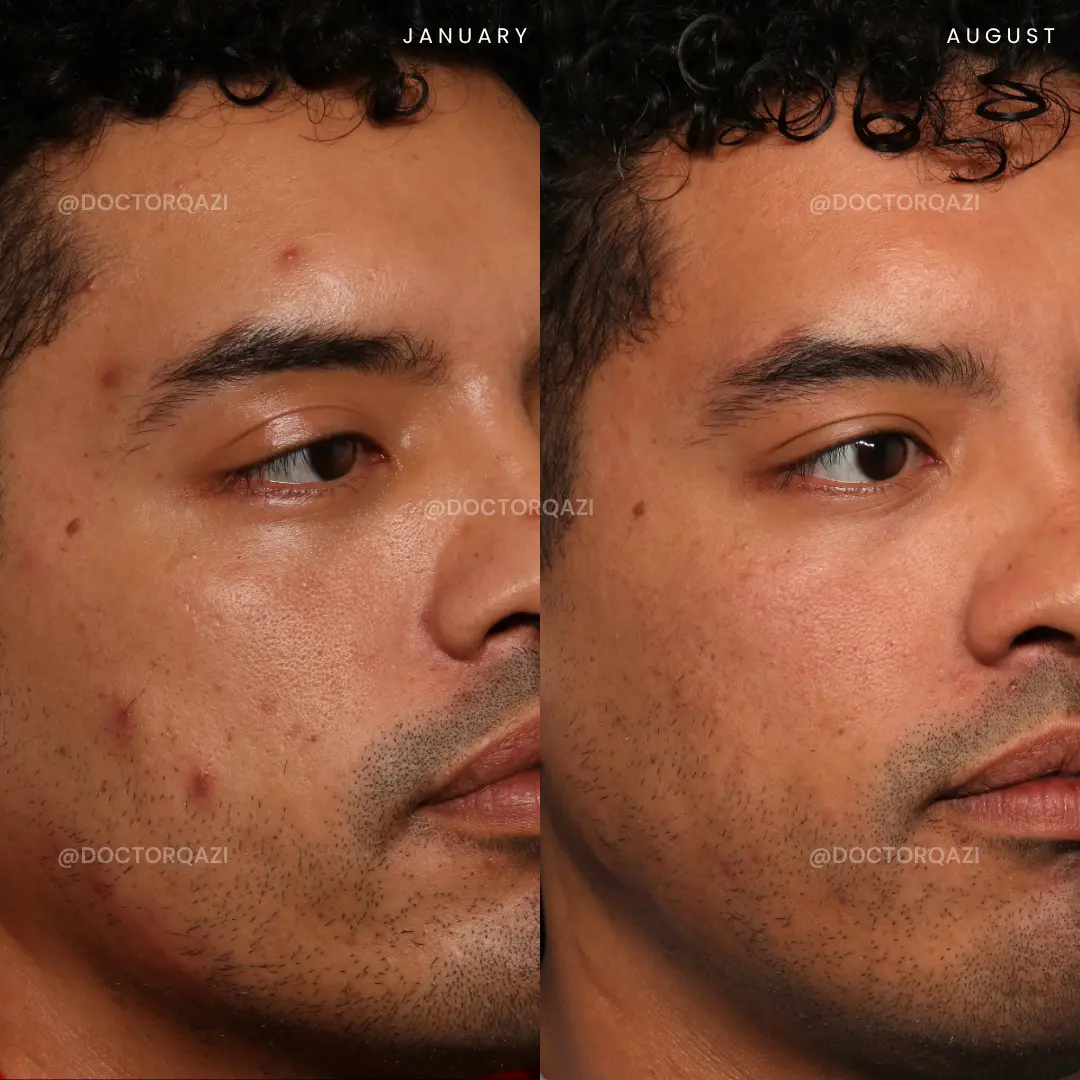 gallery.image.item,9