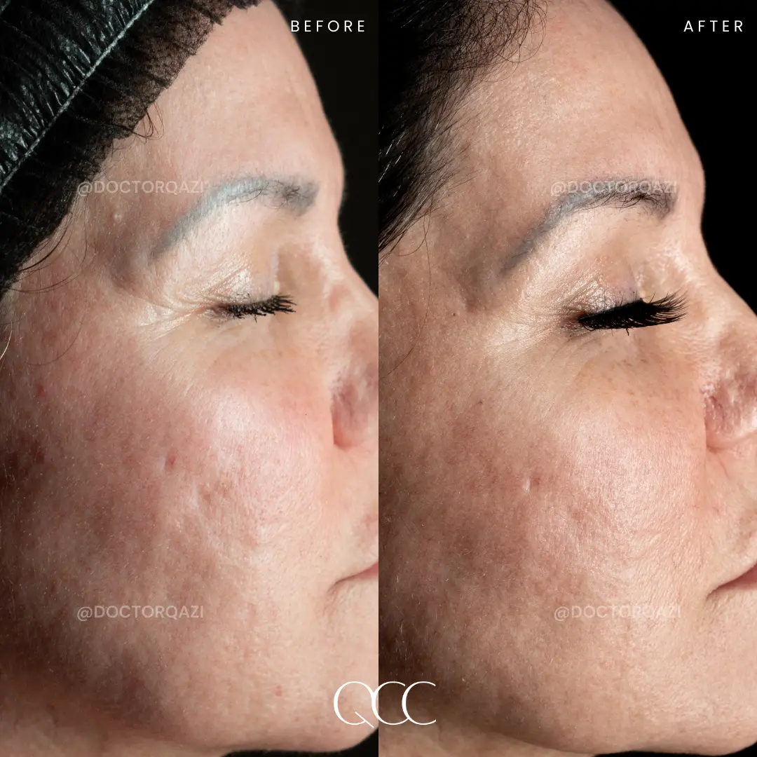 gallery.image.item,90