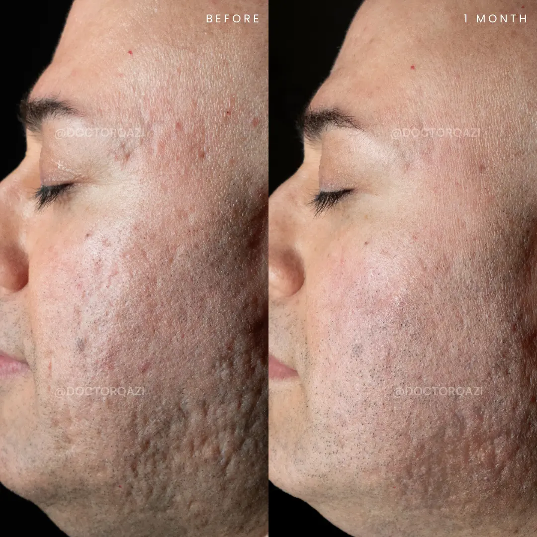 gallery.image.item,91