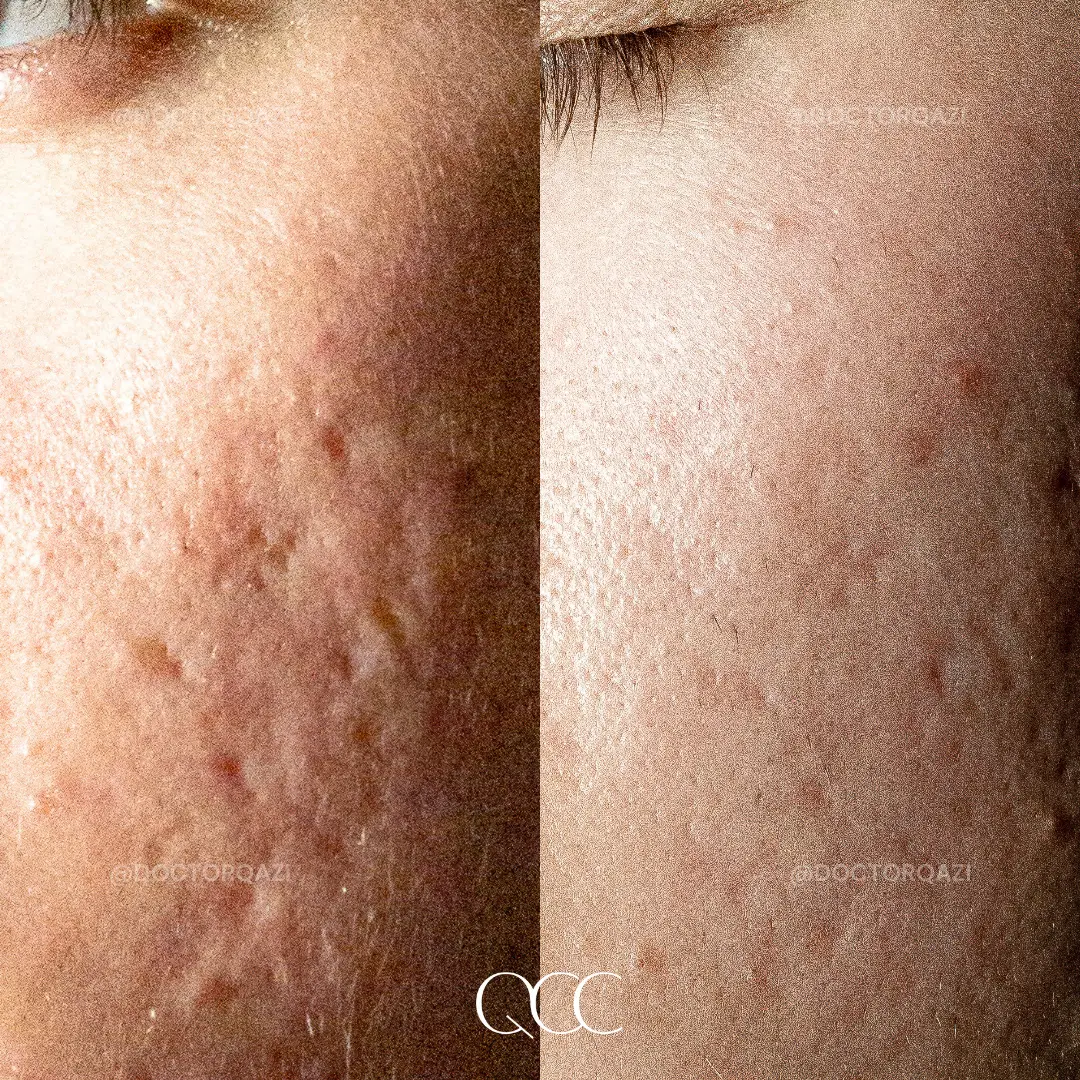 gallery.image.item,92