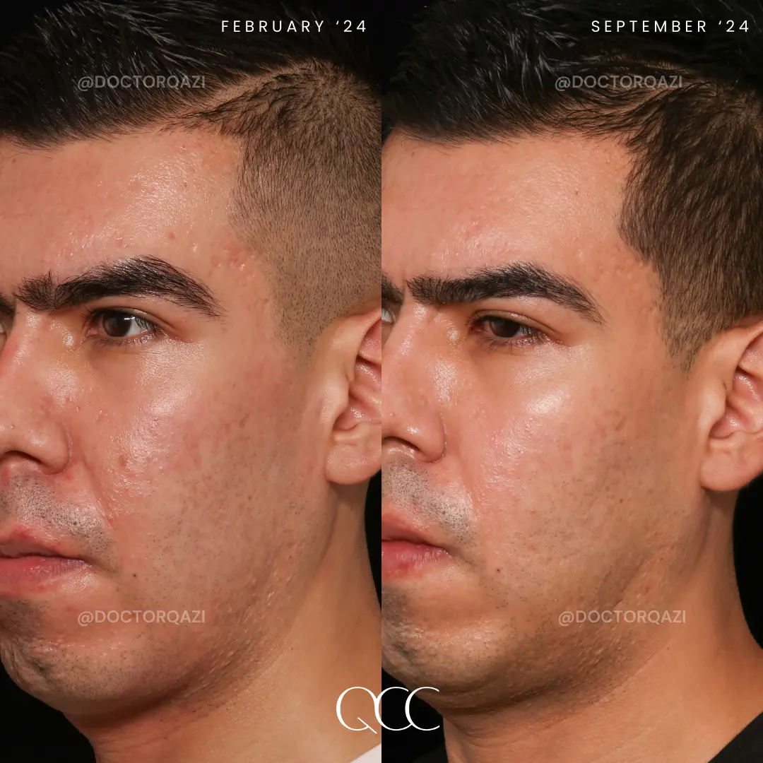 gallery.image.item,93