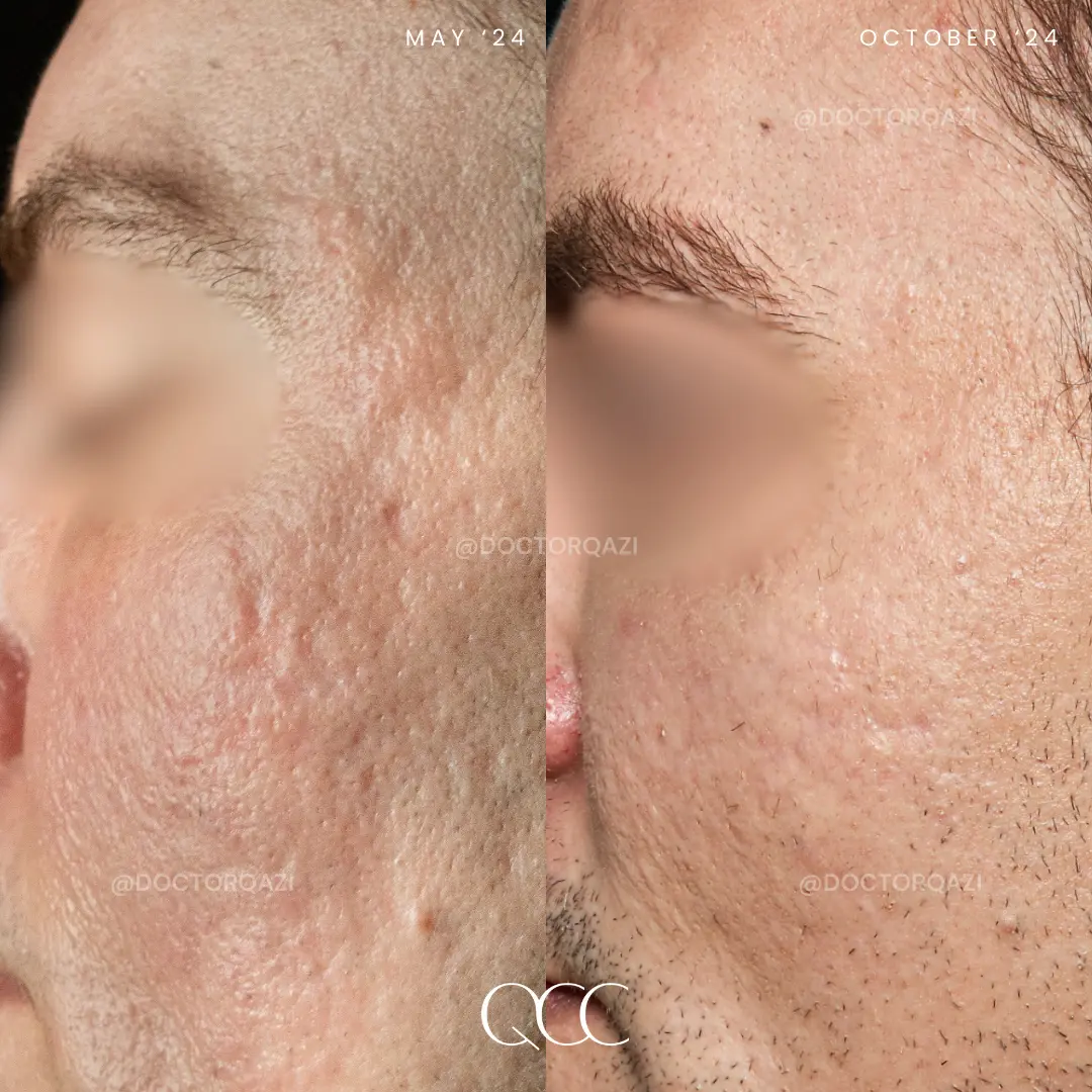 gallery.image.item,95