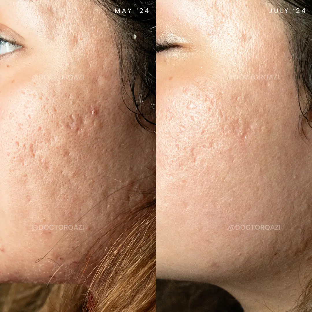 gallery.image.item,96