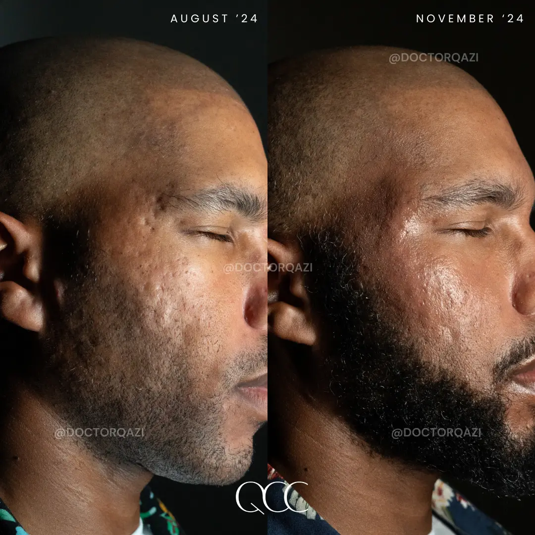 gallery.image.item,98