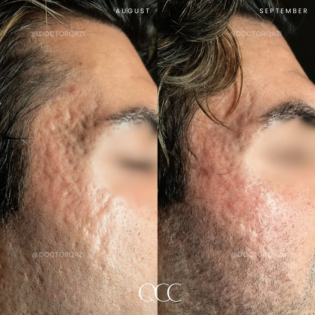 gallery.image.item,99